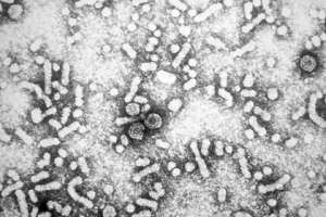 Электронная микрофотография вируса гепатита B Фото: PHIL / Wikipedia